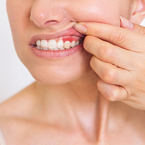 Woman with sore gums