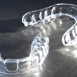Smilelign aligners