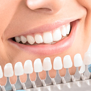 Colour of whitened teeth against scale