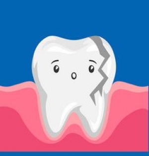 How to Avoid a Broken Tooth