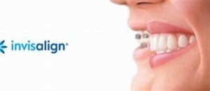 Invisalign Event 5th December 2018