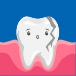 How to Avoid a Broken Tooth