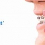 Invisalign Event 5th December 2018